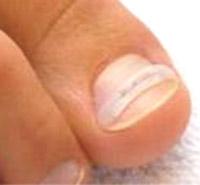 Mobile Fußpflege zum Wohlfühlen Petra Berwanger