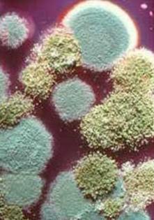 Schimmelprobleme in Duisburg