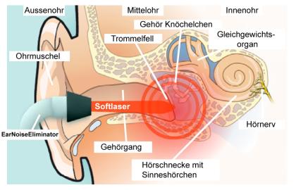 Hörsturz, Tinnitus und Drehschwindel - biologisch abbaubar?
